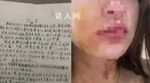 女子被夫婦毆打扒衣后吞安眠藥自殺 送醫(yī)后已搶救回來