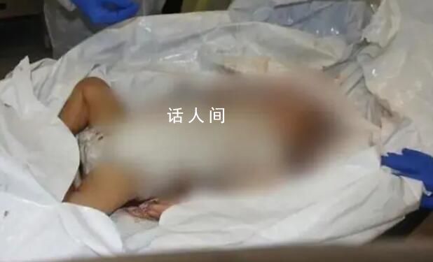 以色列公布嬰兒遇害可怕照片 消息引發國際社會關注