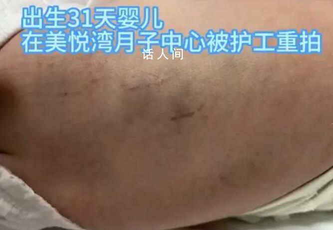 陜西月子會所護工把嬰兒打成腦損傷 監控畫面曝更多細節