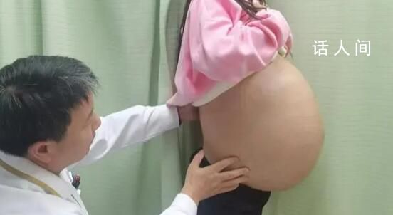 女子腹內長出重46斤巨大脂肪肉瘤 是目前重慶已知的最重脂肪肉瘤