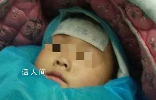 4歲女童被3只狗咬掉大半頭皮 已在重癥監護室治療一個月