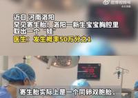 河南醫生成功分離罕見胎中胎 手術后的男嬰身體狀況良好