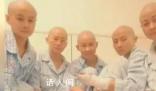 姐弟燒傷4位姨媽剃光頭捐皮膚 一對(duì)小姐弟意外重度燒傷