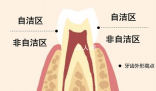刷牙最該刷的其實(shí)不是牙齒 你真的會(huì)刷牙嗎？